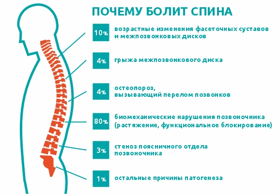 Почему болит спина
