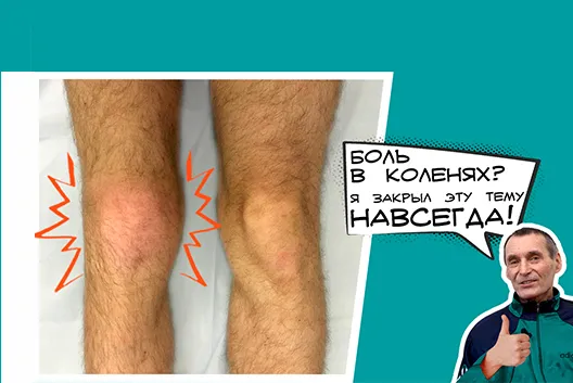 Сустав был стерт на 80%