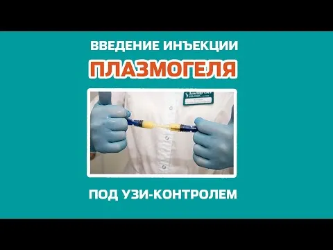 Лечение поясницы плазмогелем